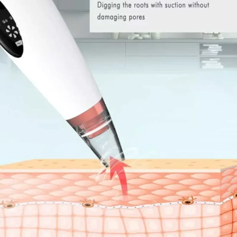 Multifunctional Cleaning Blackhead Remover Black Head Remover 3